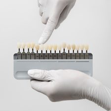 From Stains to Gaps: The Transformative Power of Veneers